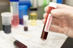 WHO, vaccine, covid 19 vaccine likely by 2021 who, Hydroxychloroquine