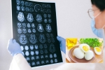 Eggs and Alzheimer’s food, Eggs and Alzheimer’s, eggs may help prevent alzheimer s study, Perc