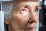 Glaucoma breaking, Glaucoma eye disease, all about the eye disease glaucoma, Brain Glaucoma breaking, Glaucoma eye disease, all about the eye disease glaucoma, Brain