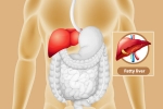 Fatty Liver problems, Fatty Liver prevention, dangers of fatty liver, Ntr