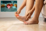 Gout Drugs on heart stroke, Gout Drugs vs Heart attack, gout drugs may cut the risk of heart attack, Jama