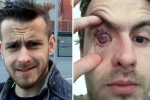 contact lens safety, why can't you wear contact lenses in the shower?, contact lens wearers beware man goes blind after parasites eat man s eye as he wore lenses in shower, Contact lens