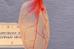 Patch For Diseased Hearts, Using Spinach Leaves Patch For Diseased Hearts, patch for diseased hearts using spinach leaves, Drummer