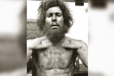 Randeep’s Shocking Transformation