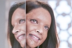 Deepika Padukone news, Deepika Padukone news, first look of deepika padukone as acid attack survivor, Padmaavat