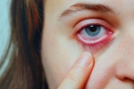 Conjunctivitis, Conjunctivitis cases, special measures to prevent conjunctivitis, Pink eye